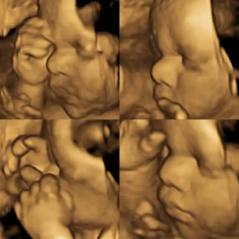 1D i den femte måned, en detaljeret forklaring med interessante billeder af fostrenes adfærd 768 768 x 1 XNUMX - Sada Al-Umma Blog