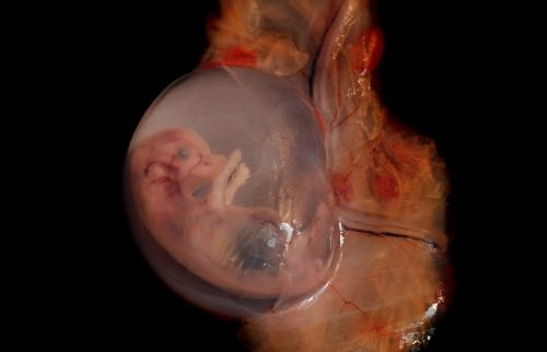 شكل الجنين المجهض في الشهر الثاني