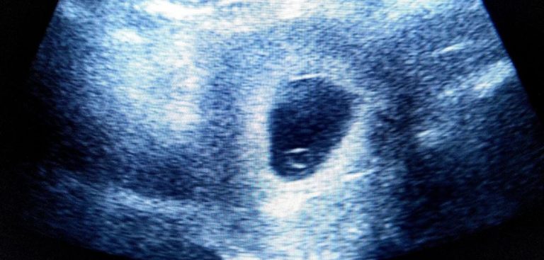 متى يبان نبض الجنين؟