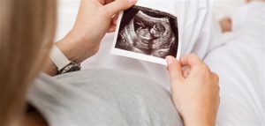 Reasons for centering the fetus on the right side