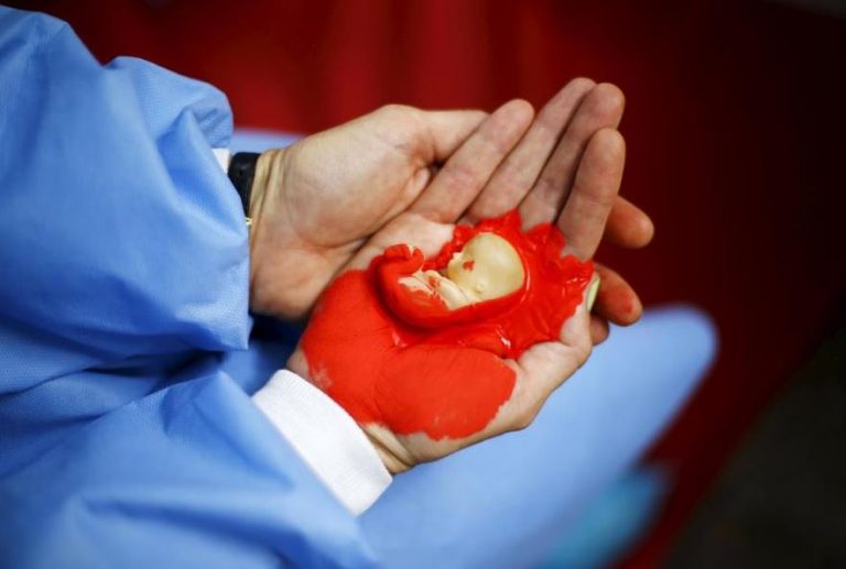 متى يطرد الرحم الجنين الميت؟