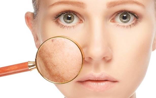 علاج احتباس السوائل في الوجه
