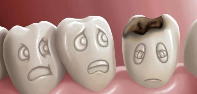 इब्न सिरीन - सदा अल-उमाह ब्लॉगद्वारे स्वप्नात कुजलेला दात पाहण्याचे सर्वात महत्वाचे 60 स्पष्टीकरण