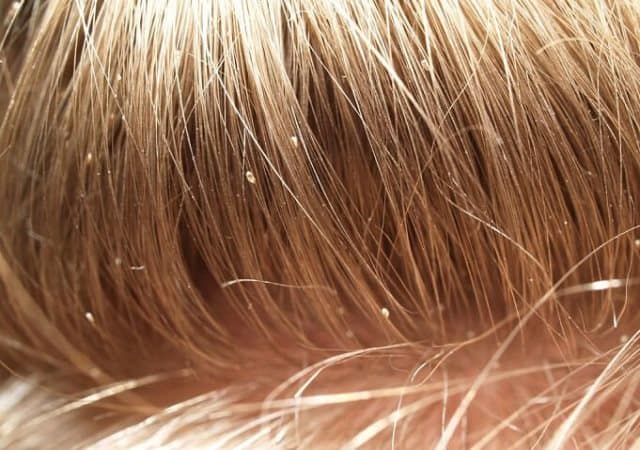 تفسير حلم الحشرات في الشعر