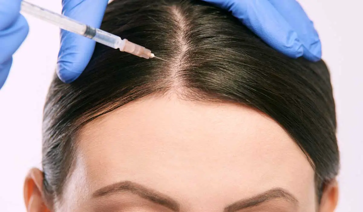 ميزوثيرابي للشعر تجربتي