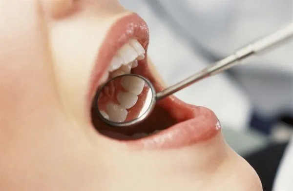 الاسنان - مدونة صدى الامة