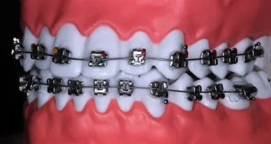 تجربتي مع تقويم الديمون