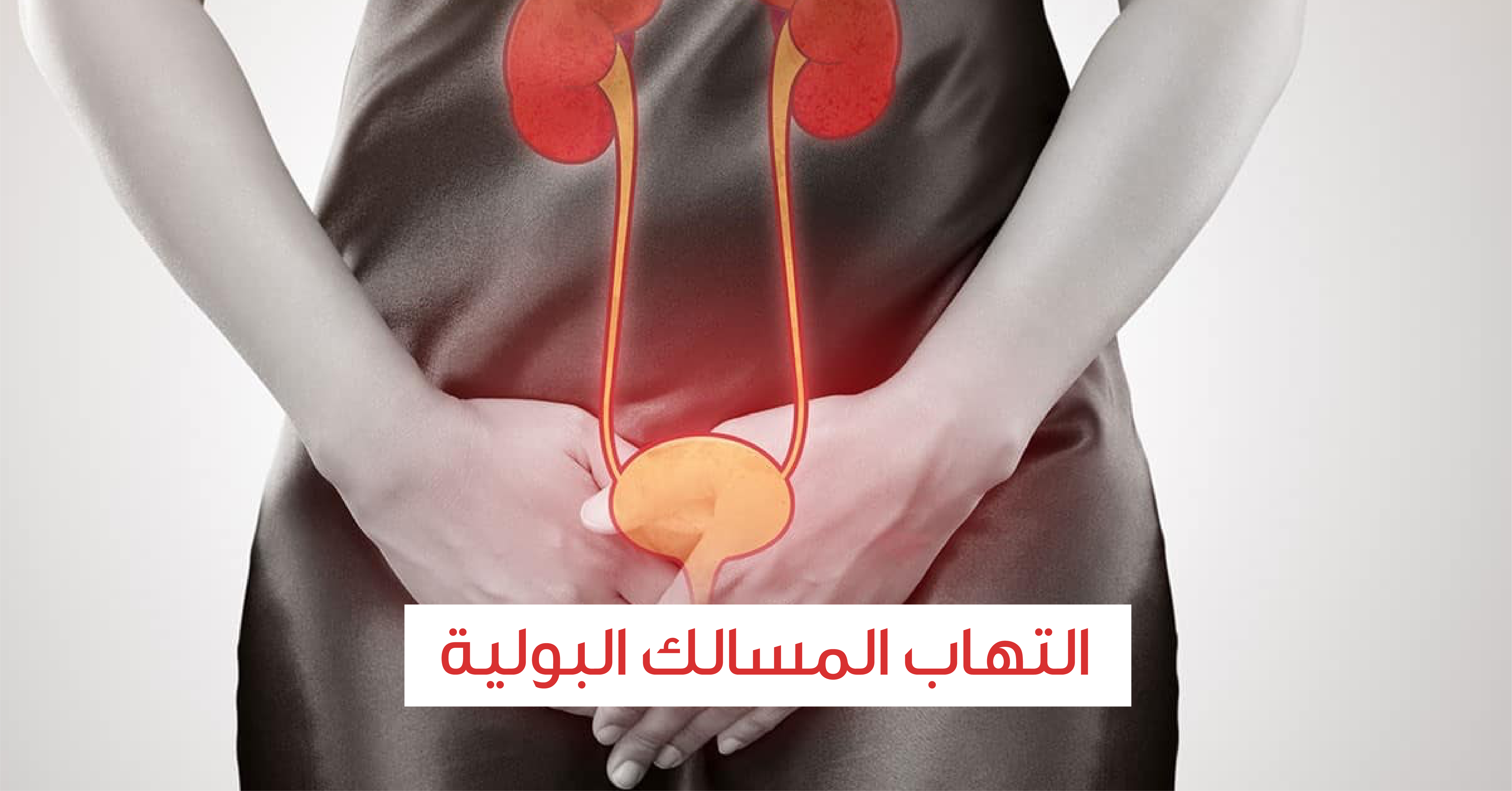 تجربتي في التخلص من التهاب البول
