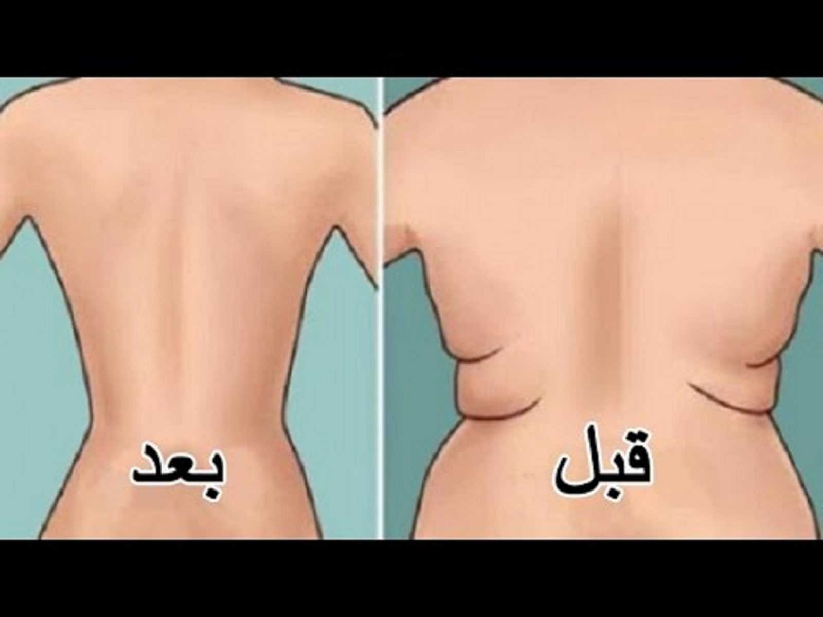 من جربت شفط دهون الظهر؟