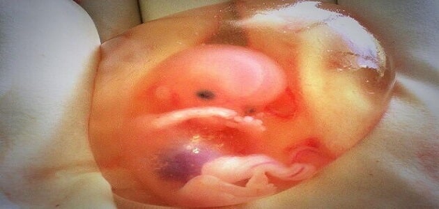 The shape of the placenta after an abortion in the second month
