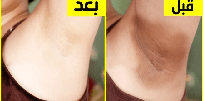 فوائد بيكربونات الصوديوم للمنطقة الحساسة