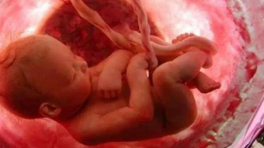 Reasons for lack of fetal movement in the seventh month