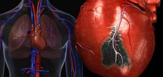 هل ارتفاع إنزيمات القلب خطيرة
