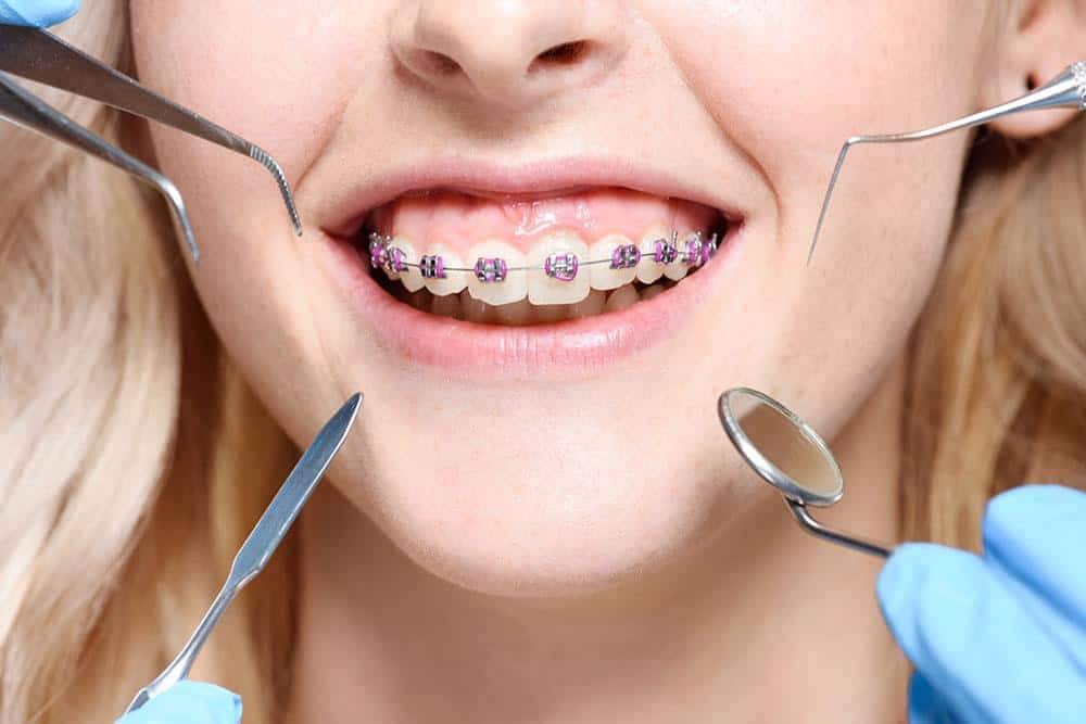 Orthodontics in Egypt - Sada Al Umma Blog