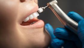 डेंटल केयर मेडिकल सेंटर में दांतों की सफाई की कीमतें अप्रतिरोध्य हैं! अभी अपना अपॉइंटमेंट बुक करें