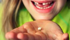 इब्न सिरिन के लिए दांत गिरने के सपने की सबसे महत्वपूर्ण 20 व्याख्या