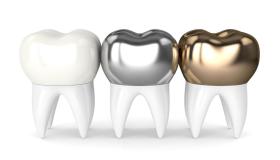 Details about the prices of dental crowns at the Medical Center for Dental Care!