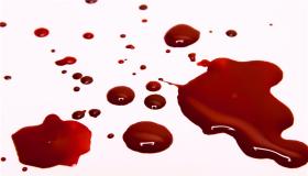 أهم 20 تفسير لرؤية الدم في المنام لابن سيرين وكبار العلماء
