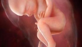 मूत्राशय में भ्रूण की गति, भ्रूण का प्रकार, और क्या भ्रूण श्रोणि में रहते हुए गति करता है?